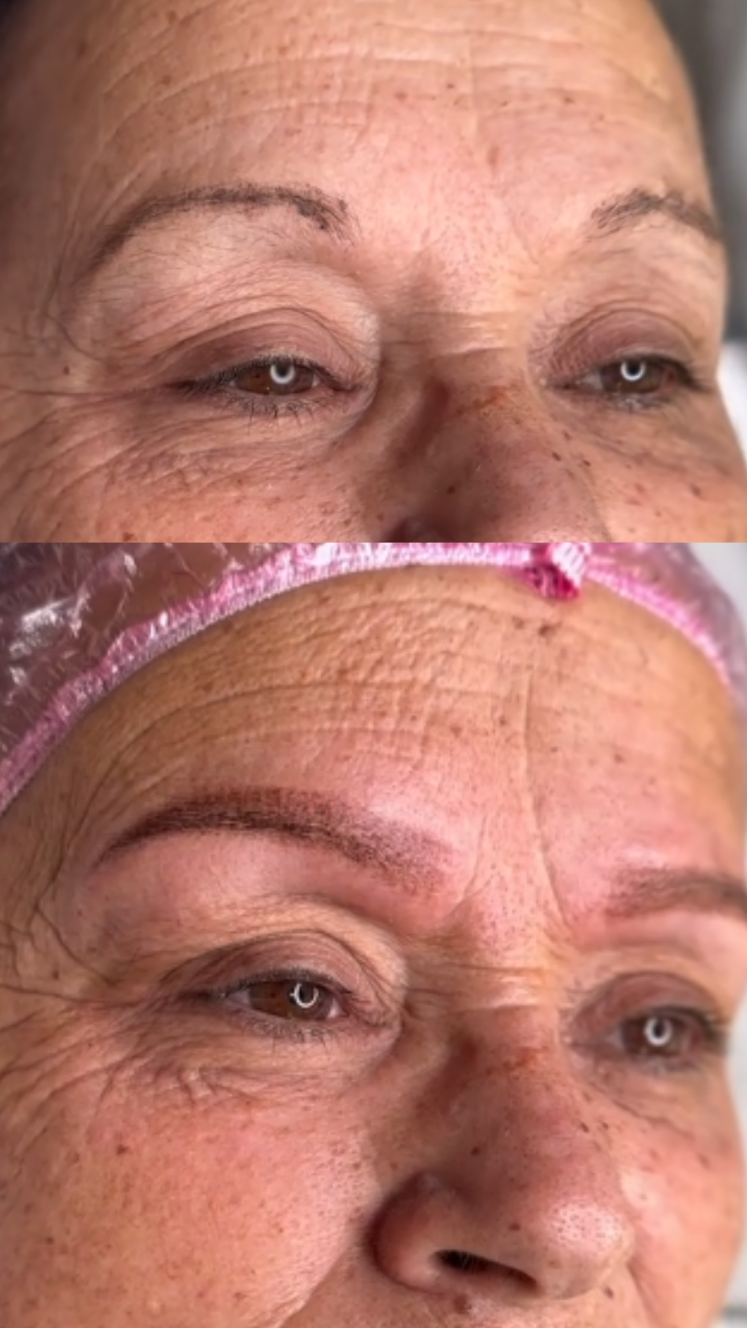 Before and After Result 4